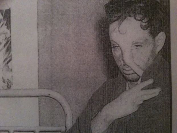 Ο Στέφανος Μολυβάδας βαρύτατα τραυματισμένος από την έκρηξη βόμβας στο αεροσκάφος του πάνω απ’το Σαράγιεβο